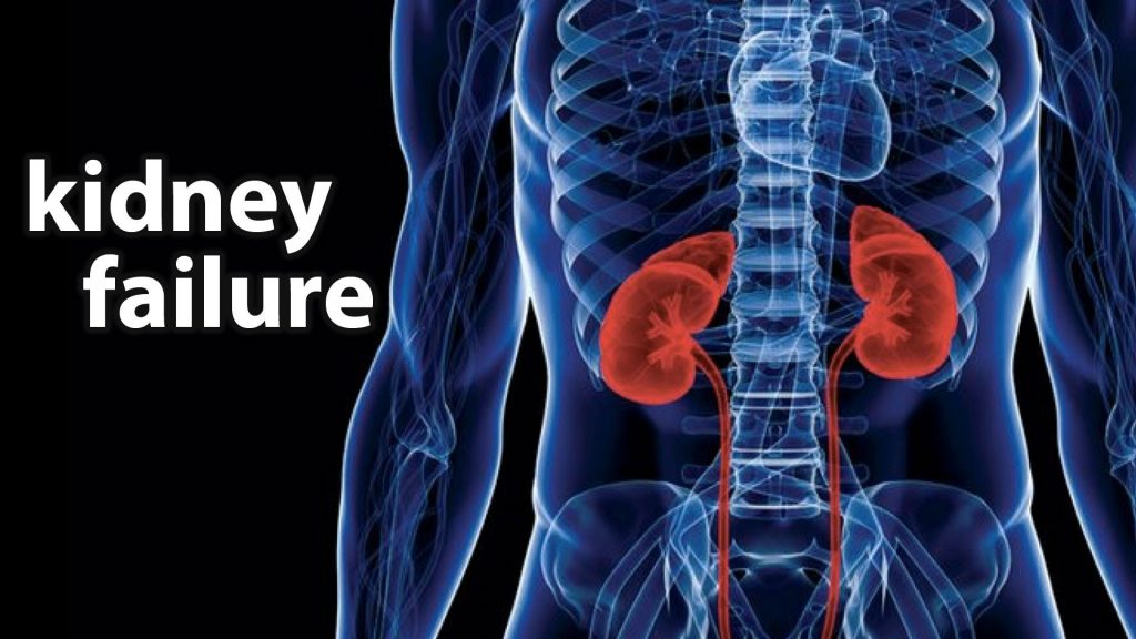 Kidney failure and treatment