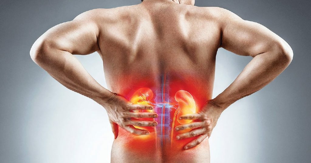 Pain Due to Kidney Problem