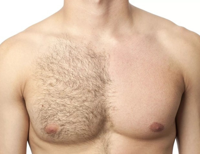 Body hair removal is an obsession