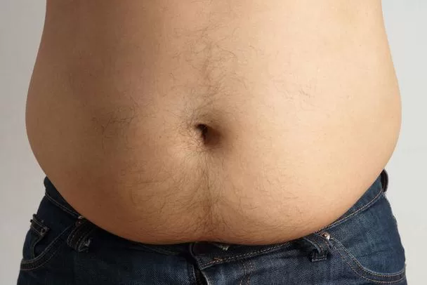 Potruding belly fat