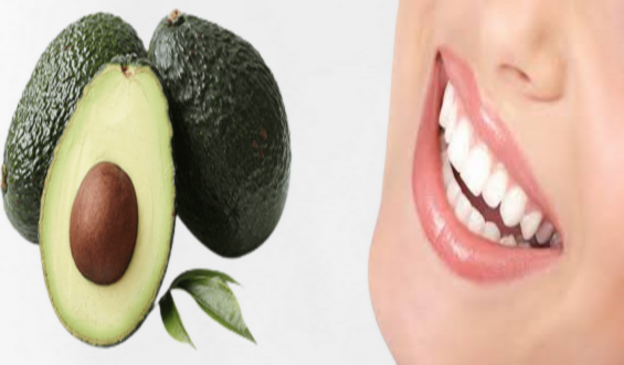 Avocado helps dental health and gums