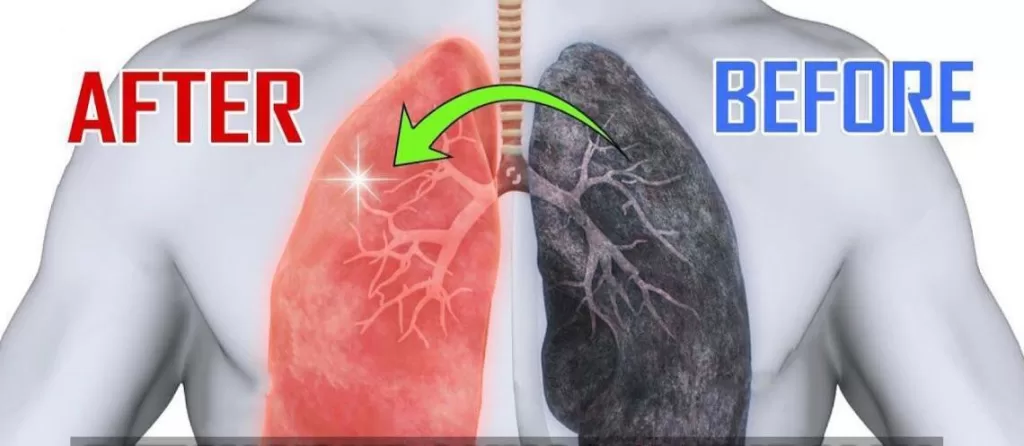 Health Lungs After and Before Treatment
