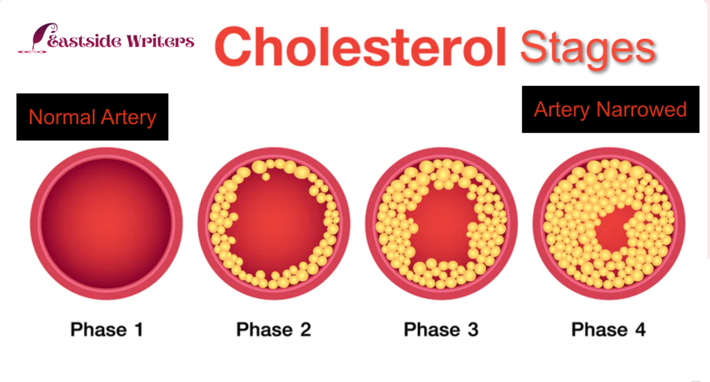 Cholesterol progression and phases