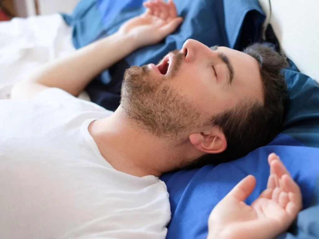 Loud snoring in sleep apnea