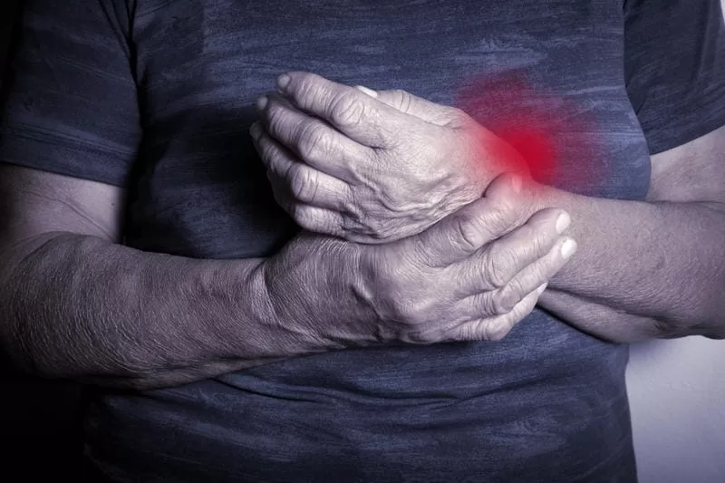 Acute pain in arthritis