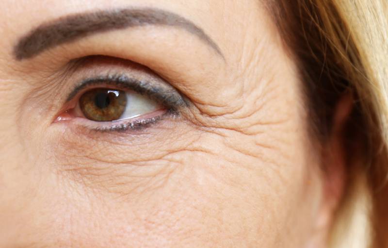 Why Wrinkles Occur?