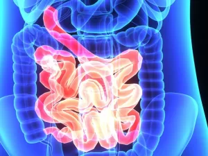 Crohn's-Disease-and-treatment