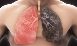 Clean lungs for Healthy life