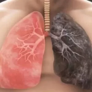 Live Healthy By Detoxing Your Lungs Naturally By Simple Techniques