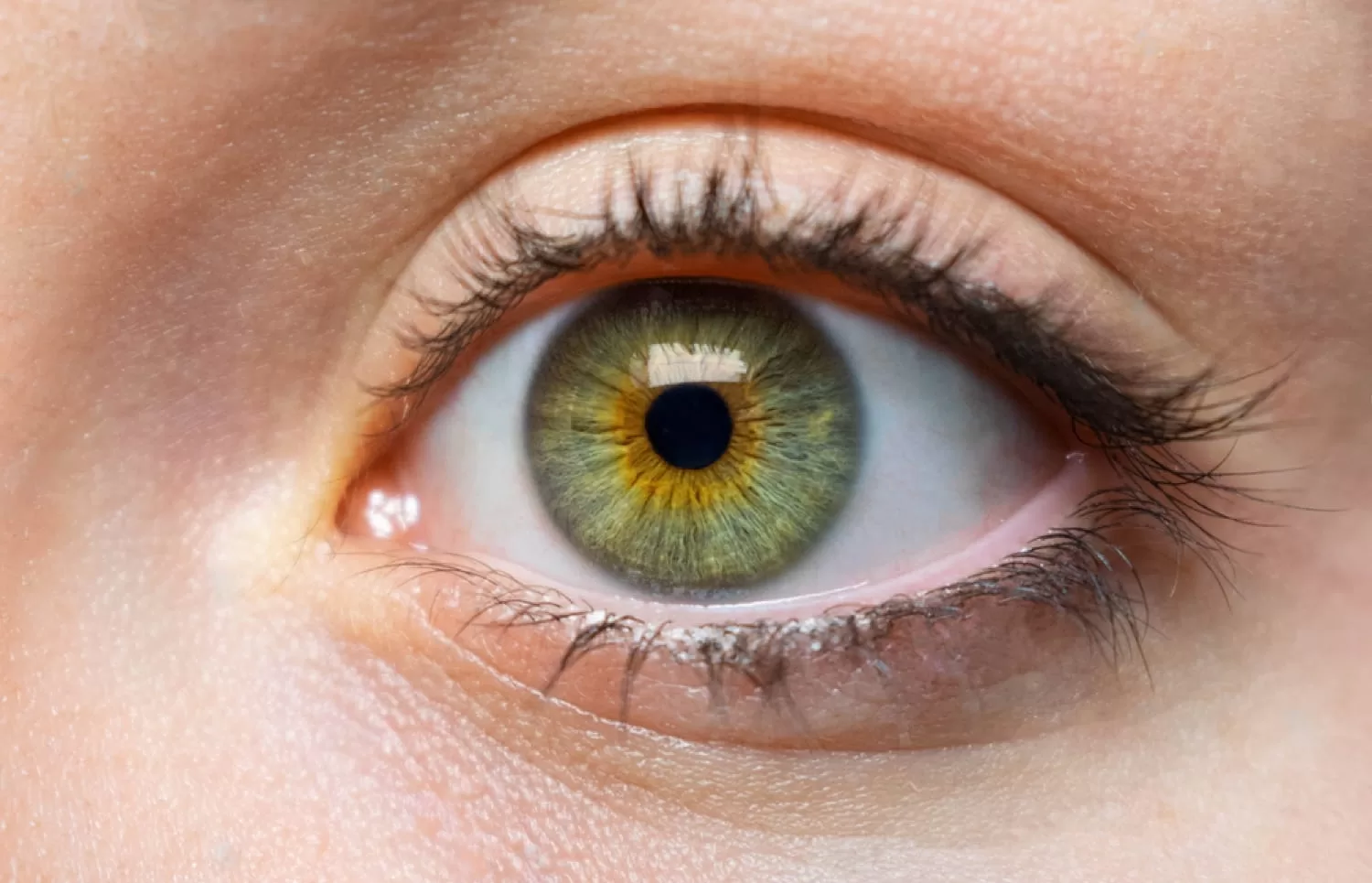 Read more about the article 14 Best Easy Home Remedies And Care For Your Dry Eyes