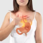 Heartburn and Acid Reflux – Understanding the Causes and Consequences on Our Body
