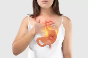 Heartburn and Acid Reflux explained