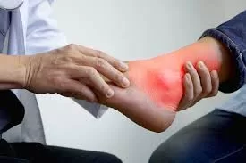 Read more about the article Gout – The Silent Attacker – Causes, Prevention, and Remedies
