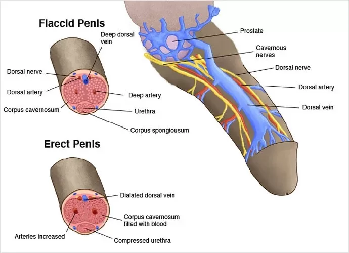 Erectile Dysfunction due to Surgery of Prostate Cancer